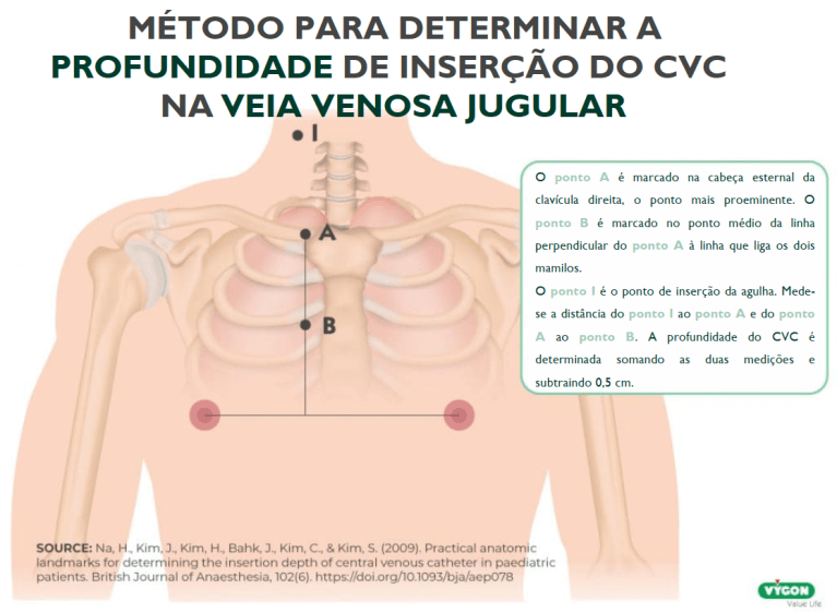 CVC jugular