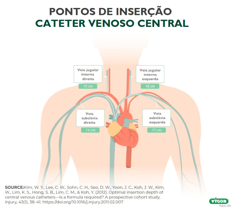 pontos inserção