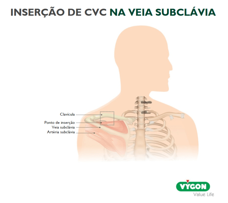 Subclavia