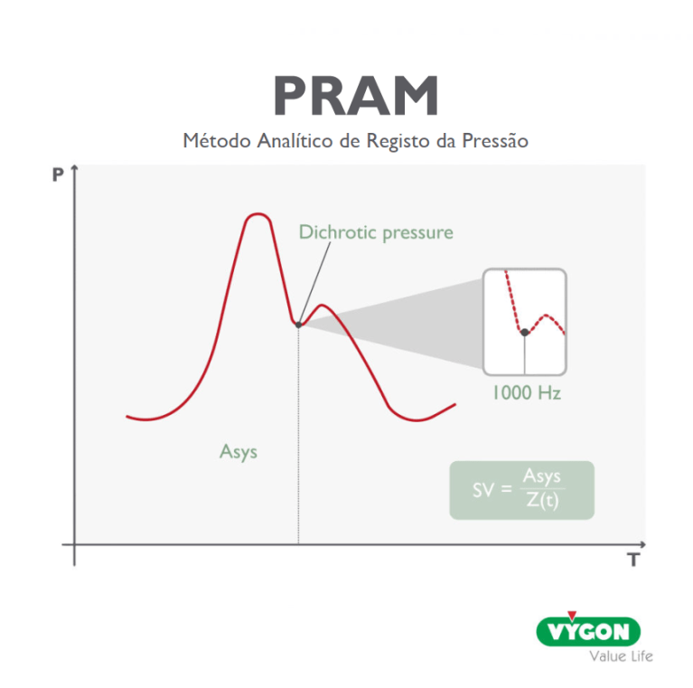 pram
